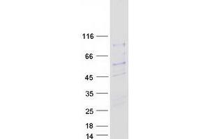 Validation with Western Blot (SIVA1 Protein (Transcript Variant 1) (Myc-DYKDDDDK Tag))