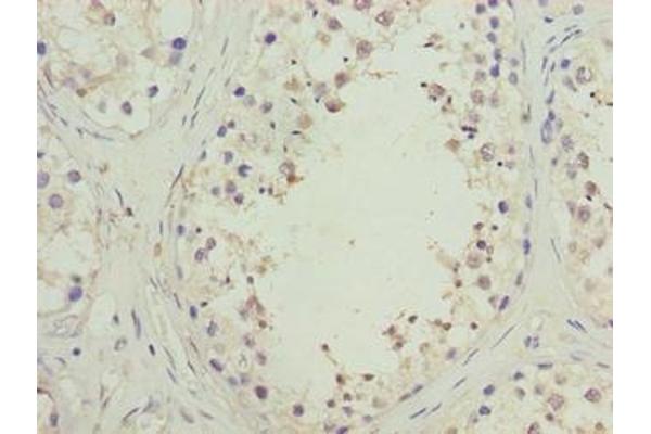 SPACA1 antibody  (AA 30-221)