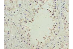 Immunohistochemistry of paraffin-embedded human testis tissue using ABIN7170448 at dilution of 1:100