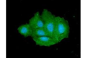 anti-Sulfotransferase Family, Cytosolic, 2A, Dehydroepiandrosterone (DHEA)-Preferring, Member 1 (SULT2A1) (AA 1-285) antibody