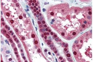 Human Kidney (formalin-fixed, paraffin-embedded) stained with MAT2A antibody ABIN364446 at 10 ug/ml followed by biotinylated anti-mouse IgG secondary antibody ABIN481714, alkaline phosphatase-streptavidin and chromogen. (MAT2A antibody  (AA 1-395))