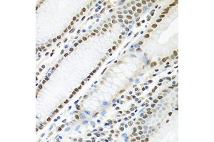 Immunohistochemistry of paraffin-embedded human stomach using PTBP1 antibody (ABIN5995415) at dilution of 1/100 (40x lens). (PTBP1 antibody)
