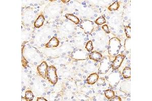 Immunohistochemistry of paraffin embedded rat kidney using ATP1A1 (ABIN7073154) at dilution of 1: 500 (400x lens) (ATPase (Na/K) antibody)