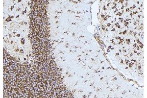 ABIN6277161 at 1/100 staining Mouse brain tissue by IHC-P.