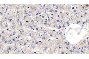 Detection of FGF23 in Human Liver Tissue using Polyclonal Antibody to Fibroblast Growth Factor 23 (FGF23) (FGF23 antibody  (AA 79-160))