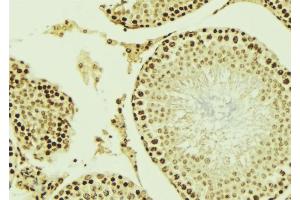 ABIN6276866 at 1/100 staining Mouse testis tissue by IHC-P. (AIRE antibody  (Internal Region))