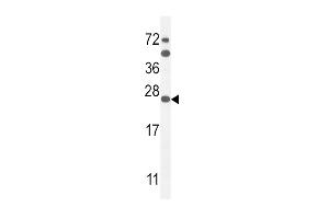 SCN1B Antibody (N-Term) (ABIN654602 and ABIN2844301) western blot analysis in mouse Neuro-2a cell line lysates (35 μg/lane). (SCN1B antibody  (N-Term))