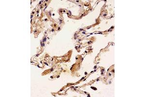 Paraformaldehyde-fixed, paraffin embedded human lung tissue, Antigen retrieval by boiling in sodium citrate buffer (pH6. (S100A2 antibody)