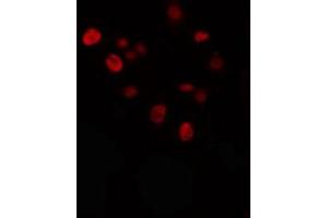 ABIN6274336 staining Hela cells by IF/ICC. (KLF antibody)