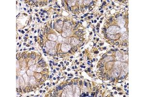 Immunohistochemistry of paraffin-embedded Human colon using ARRB2 Polyclonal Antibody at dilution of 1:200 (40x lens). (Arrestin 3 antibody)
