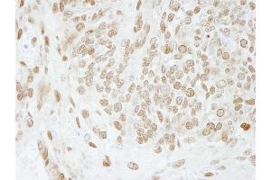 Immunohistochemistry (IHC) image for anti-Activated RNA Polymerase II Transcriptional Coactivator p15 (SUB1) (AA 77-127) antibody (ABIN7448719) (SUB1 antibody  (AA 77-127))