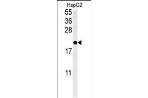 Western blot analysis in HepG2 cell line lysates (35ug/lane). (SFT2D3 antibody  (N-Term))