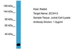 Image no. 1 for anti-Zinc Finger CCCH-Type Containing 13 (ZC3H13) (AA 1455-1504) antibody (ABIN6750587) (ZC3H13 antibody  (AA 1455-1504))