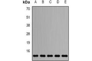 Western blot analysis of Sm-D2 expression in HepG2 (A), Jurkat (B), mouse testis (C), mouse heart (D), rat brain (E) whole cell lysates. (SNRPD2 antibody)