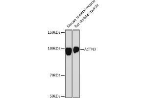 Western blot analysis of extracts of various cell lines, using  Rabbit mAb (ABIN7265398) at 1:1000 dilution. (ACTN3 antibody)