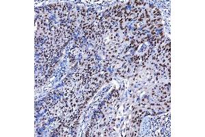 IHC analysis of SF3A1 using anti-SF3A1 antibody (ABIN7600556). (SF3A1 antibody  (AA 20-556))