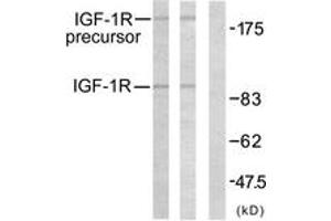 Western blot analysis of extracts from 293 cells, treated with Insulin, using IGF1R (Ab-1161) Antibody. (IGF1R antibody  (AA 1126-1175))