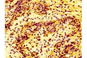 IHC image of ABIN7159070 diluted at 1:100 and staining in paraffin-embedded human lung tissue performed on a Leica BondTM system. (MMP28 antibody  (AA 351-475))