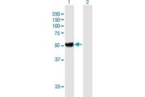 Western Blot analysis of KIAA0368 expression in transfected 293T cell line by KIAA0368 MaxPab polyclonal antibody. (ECM29 antibody  (AA 1-519))