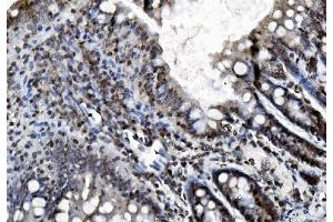 IHC analysis of REA/PHB2 using anti-REA/PHB2 antibody (ABIN7599239).