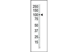 PI4KB antibody  (N-Term)