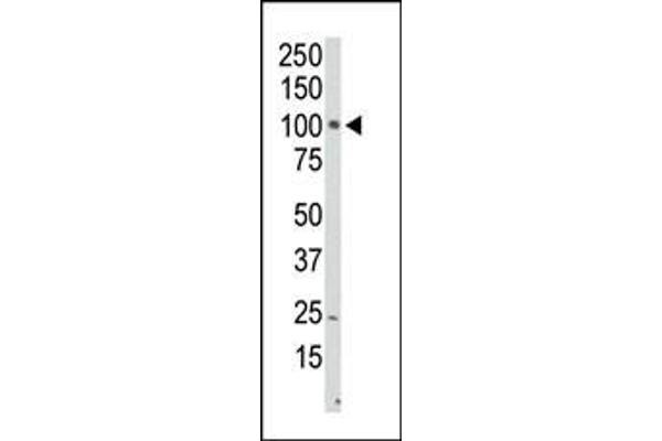 PI4KB antibody  (N-Term)