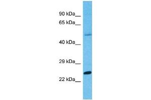 Western Blotting (WB) image for anti-Protease, serine, 45 (PRSS45) (C-Term) antibody (ABIN2791882) (PRSS45 antibody  (C-Term))
