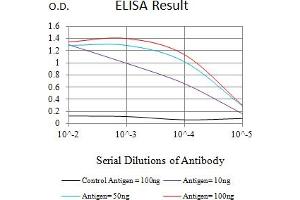 Black line: Control Antigen (100 ng),Purple line: Antigen (10 ng), Blue line: Antigen (50 ng), Red line:Antigen (100 ng) (Caldesmon antibody  (AA 26-207))