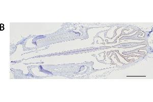 Immunohistochemistry analysis of the expression of the mu and alpha class GSTs. (GSTM4 antibody  (AA 21-215))