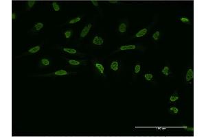 Immunofluorescence of monoclonal antibody to ZIC4 on HeLa cell. (ZIC4 antibody  (AA 1-90))