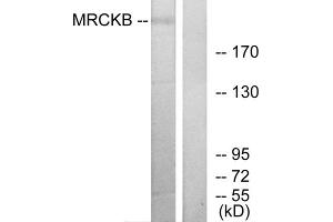 Western blot analysis of extracts from COLO cells, using MRCKB antibody.