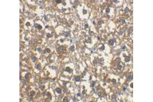 Immunohistochemical staining of rat liver cells using AP30443PU-N IRAK-M antibody at 2 μg/ml. (IRAK3 antibody)