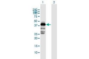 Western Blot analysis of MAGEA3 expression in transfected 293T cell line by MAGEA3 MaxPab polyclonal antibody. (MAGEA3 antibody  (AA 1-314))