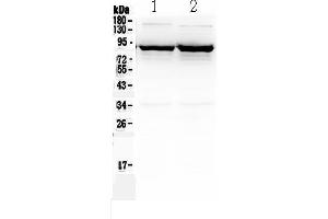 Western blot analysis of SLC6A1 using anti-SLC6A1 antibody .