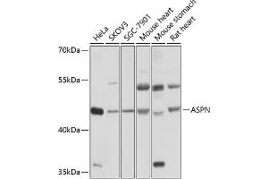 Western blot analysis of extracts of various cell lines, using ASPN antibody (ABIN6127375, ABIN6137217, ABIN6137218 and ABIN6214518) at 1:1000 dilution. (Asporin antibody  (AA 100-379))