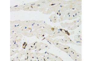 Immunohistochemistry of paraffin-embedded Rat heart using THAP1 Polyclonal Antibody at dilution of 1:100 (40x lens). (THAP1 antibody)