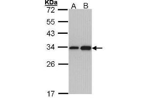WB Image Sample (30 ug of whole cell lysate) A: Hep G2 , B: Molt-4 , 12% SDS PAGE antibody diluted at 1:1000 (RPL8 antibody)