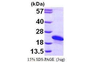 SDS-PAGE (SDS) image for ADP-Ribosylation Factor-Like 2 Binding Protein (ARL2BP) (AA 1-163) protein (His tag) (ABIN667251)