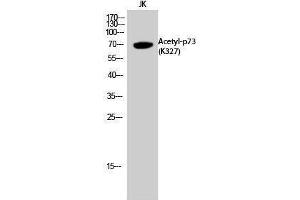 Western Blotting (WB) image for anti-Tumor Protein P73 (TP73) (acLys327) antibody (ABIN3172843) (Tumor Protein p73 antibody  (acLys327))