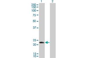 Western Blot analysis of LOC51136 expression in transfected 293T cell line by LOC51136 monoclonal antibody (M01), clone 4H7. (RNFT1 antibody  (AA 1-100))