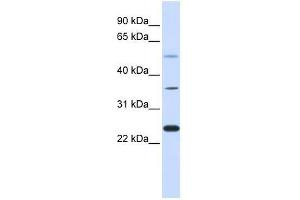 ZNF488 antibody used at 0. (ZNF488 antibody  (Middle Region))