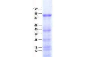 Validation with Western Blot (ZNF175 Protein (His tag))