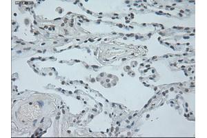 Immunohistochemical staining of paraffin-embedded lung tissue using anti-OSMmouse monoclonal antibody. (Oncostatin M antibody  (AA 25-252))