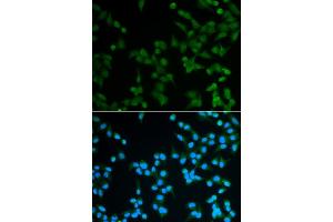Immunofluorescence analysis of A549 cells using SPIN1 antibody (ABIN5973464). (Spindlin 1 antibody)