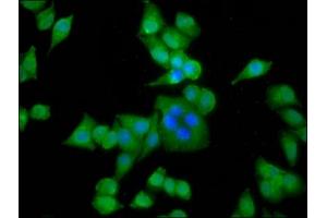 Immunofluorescence staining of Hela cells with ABIN7143823 at 1:133, counter-stained with DAPI. (ACTN3 antibody  (AA 497-667))