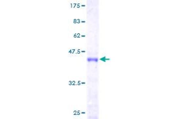 BTF3 Protein (AA 1-162) (GST tag)