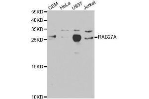 Western Blotting (WB) image for anti-RAB27A, Member RAS Oncogene Family (RAB27A) antibody (ABIN1874505) (RAB27A antibody)