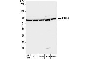 Western Blotting (WB) image for anti-Peptidylprolyl Isomerase (Cyclophilin)-Like 4 (PPIL4) (AA 375-425) antibody (ABIN7450591) (PPIL4 antibody  (AA 375-425))