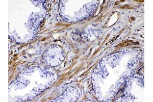 IHC analysis of VEGF Receptor 3 using anti-VEGF Receptor 3 antibody . (FLT4 antibody)