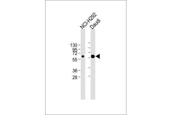 IFI44L anticorps  (C-Term)
